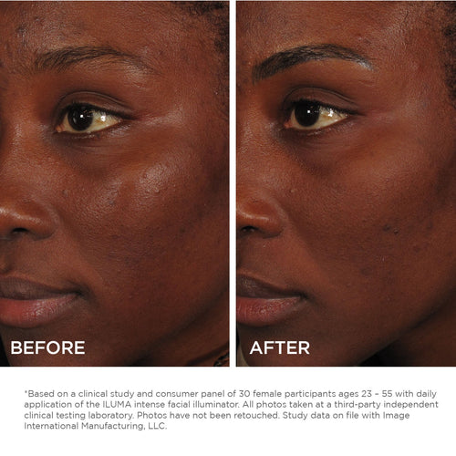 Iluma Intense Facial Iluminator